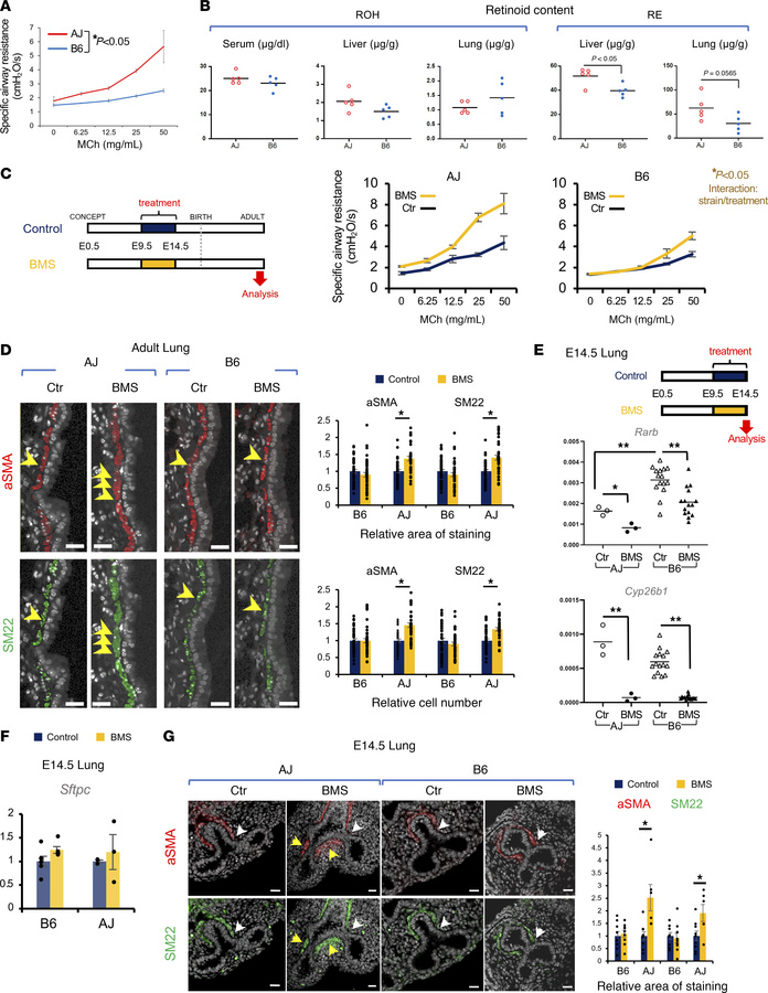 Genetic background determines airway smooth muscle (SM) program and airw...