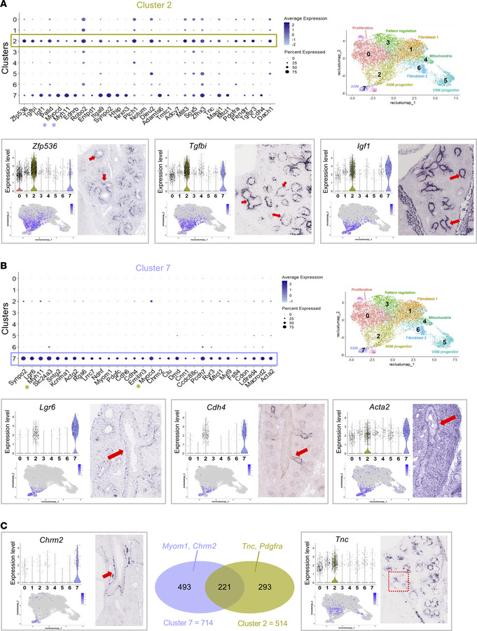 Multiomics analysis identifies 2 distinct stages of airway SM cell progr...