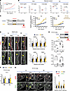 Genetic background determines airway smooth muscle (SM) program and airway