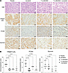 Immunohistochemistry of tumor tissues.