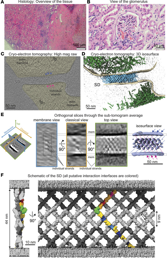 Architecture of the human glomerular filtration system.
(A) Histology im...