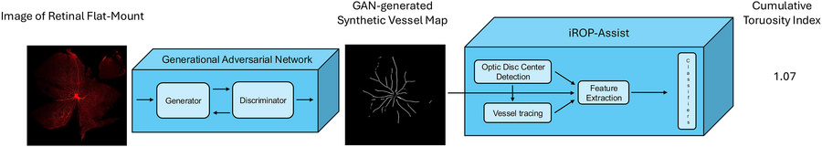 AI-based calculation of vascular tortuosity.
In our previous publication...