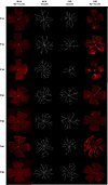 Representative images of NOX and OIR flat mounts with AI-generated vessel s
