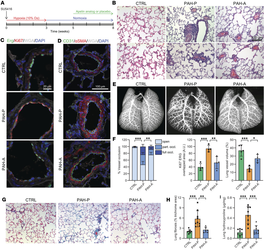 Apelin analog treatment reverses pulmonary vascular remodeling and fibro...