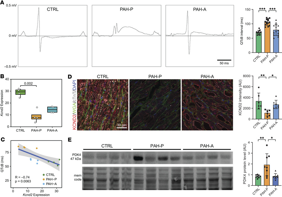 Apelin analog treatment reverses electrical and metabolic remodeling of ...