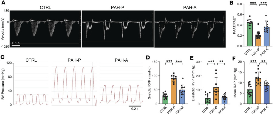 Apelin analog treatment reverses pulmonary hemodynamic abnormalities in ...