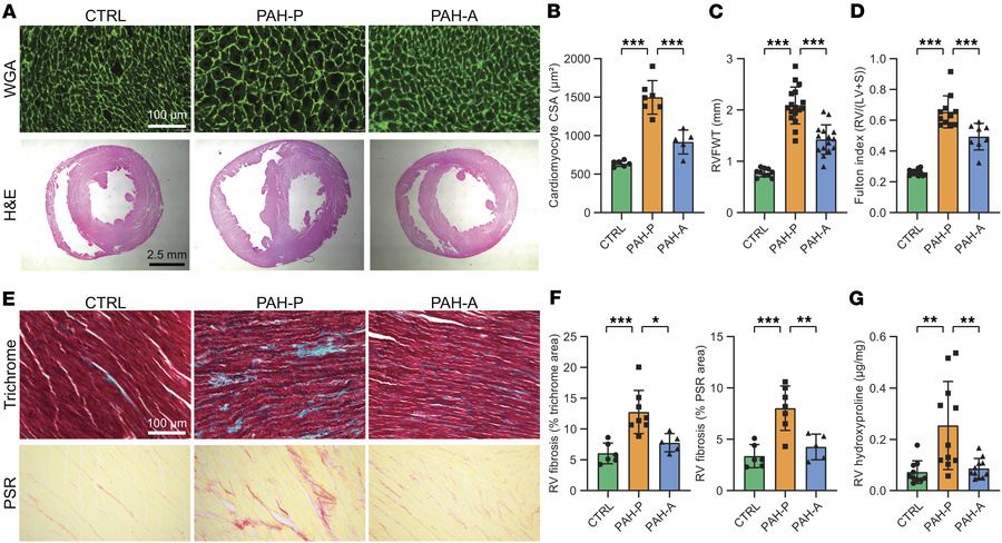 Apelin analog treatment reverses right ventricular hypertrophy and fibro...