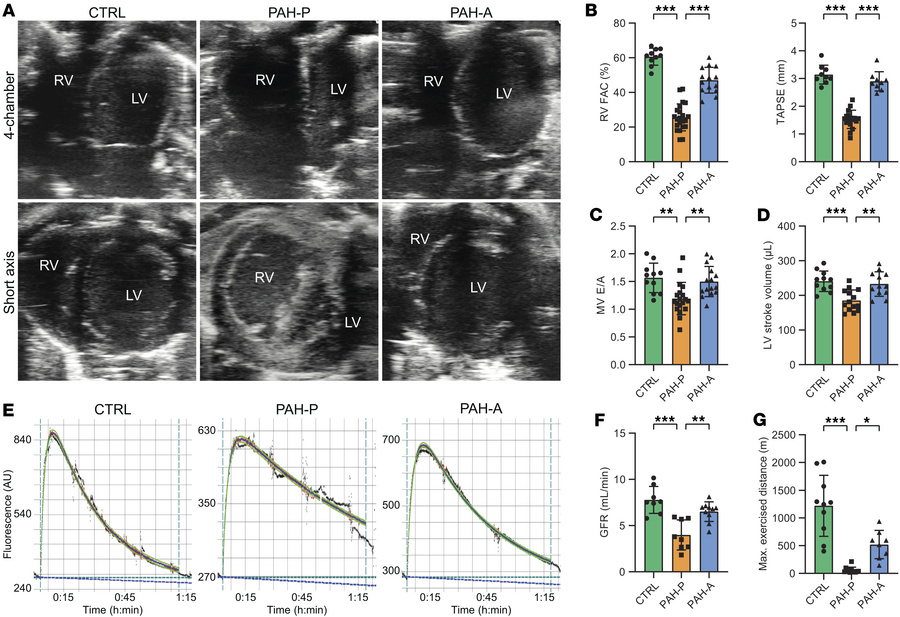 Apelin analog treatment restores right ventricular function, renal perfu...