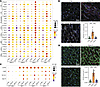 Apelin analog treatment normalizes fibroblast activation and myeloid cell s