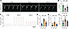 Apelin analog treatment reverses pulmonary hemodynamic abnormalities in pul