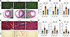 Apelin analog treatment reverses right ventricular hypertrophy and fibrosis