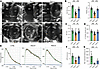 Apelin analog treatment restores right ventricular function, renal perfusio