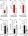 Angiotensin signaling in stress erythropoiesis promotes the accumulation of