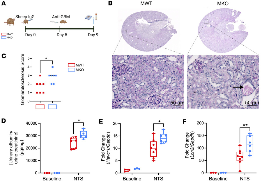 Myeloid IL-1R1 deletion worsens NTS nephritis.
(A) MWT and MKO mice were...