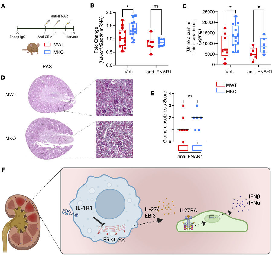 Anti-IFNAR1 therapy abrogates exaggerated albuminuria and kidney injury ...