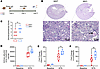 Myeloid IL-1R1 deletion worsens NTS nephritis.