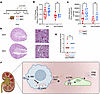 Anti-IFNAR1 therapy abrogates exaggerated albuminuria and kidney injury in