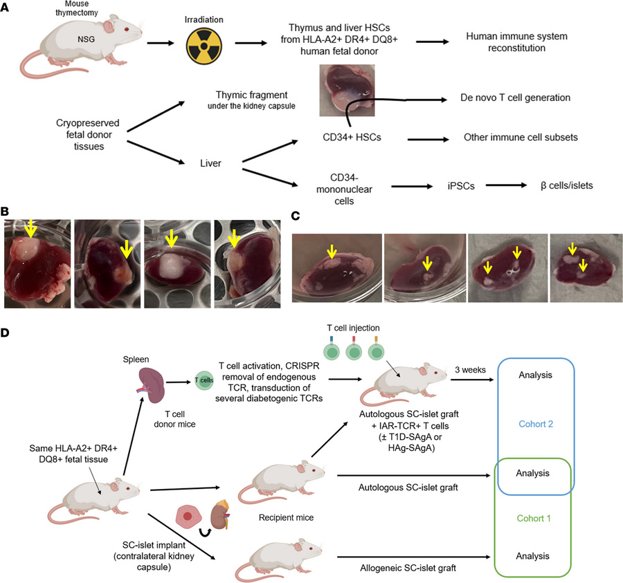 Experimental design.
(A) HIS mouse generation using transplanted human f...
