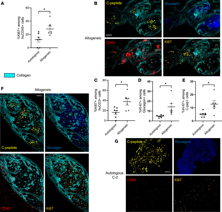 Proliferation in allogeneic grafts based on Ki67 expression.
(A) Quantif...