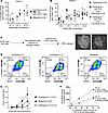 Human immune system and stem cell–derived islet reconstitution.