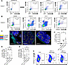 Undetectable infiltration by autologous IAR-T cells.