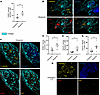 Proliferation in allogeneic grafts based on Ki67 expression.