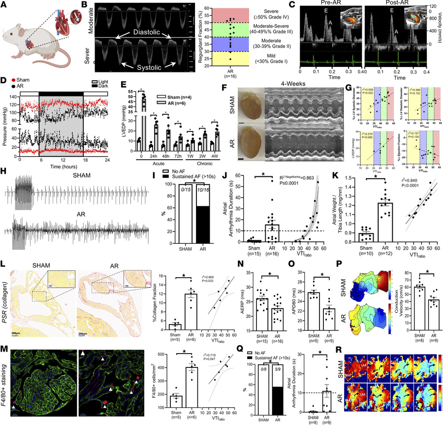 Graded aortic regurgitation (AR) induces atrial remodeling and atrial fi...