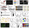 Graded aortic regurgitation (AR) induces atrial remodeling and atrial fibri