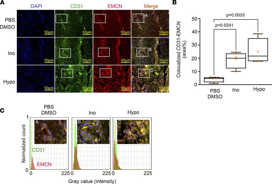 Inosine and hypoxanthine promote the formation of type H vessels in indu...