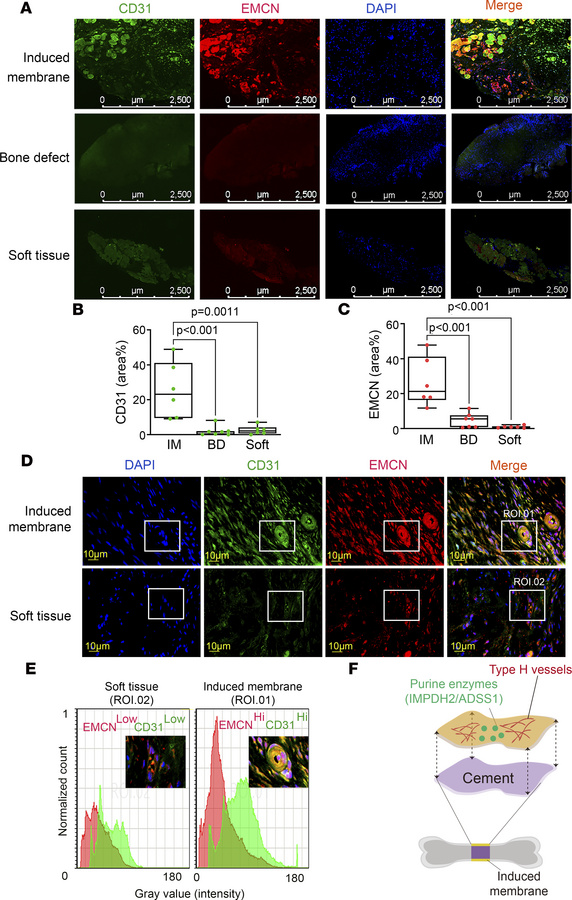 Phenotype of type H vessels is identified in the induced membrane.
(A) R...