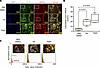 Inosine and hypoxanthine promote the formation of type H vessels in induced