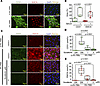 Endothelial activation in HUVECs is associated with changes in type H marke