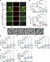 Inhibition of purine metabolism suppresses angiogenic capacity and type H p