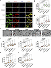 Purine metabolites promote angiogenic capacity and type H phenotype in HUVE