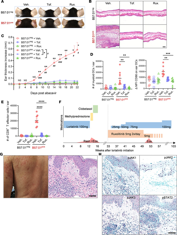 JAKi prophylaxis may prevent DHR in mice and humans.
(A and B) Represent...
