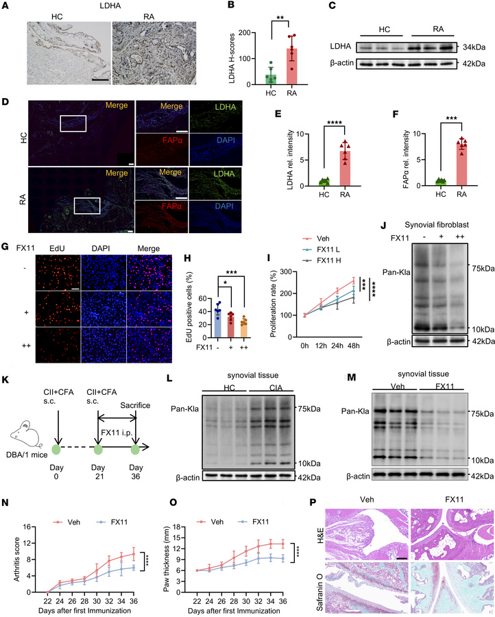 Inhibition of lactate metabolism reduces synovial proliferation.
(A and ...