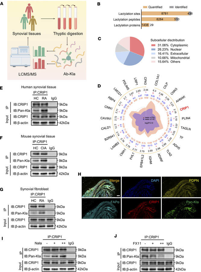 CRIP1 protein lactylation promotes synovial proliferation in RA.
(A) Sch...