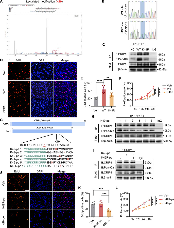CRIP1 K49 lactylation facilitates synovial proliferation in RA.
(A) MS/M...
