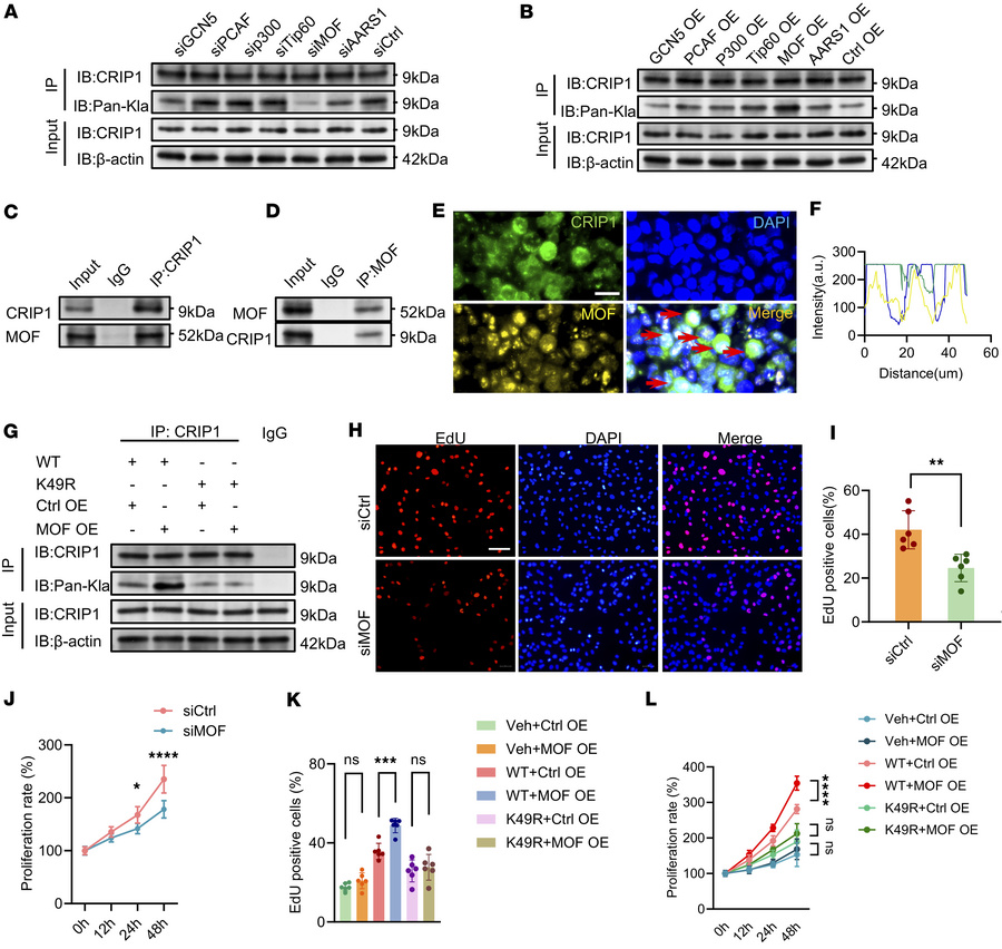 MOF mediates CRIP1 protein lactylation and synovial proliferation in RA....