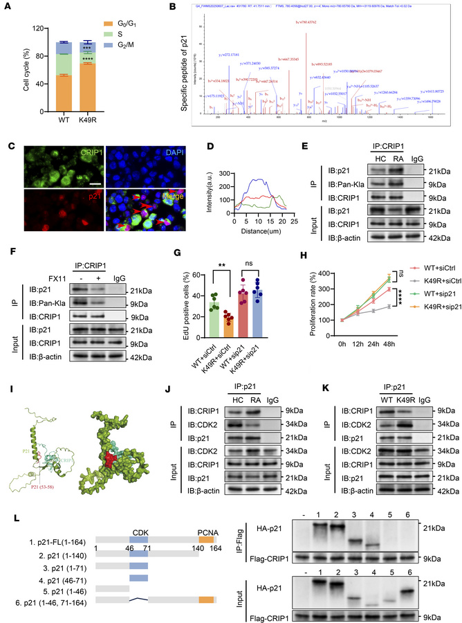 CRIP1 protein lactylation affects p21-CDK2 axis to promote synovial prol...