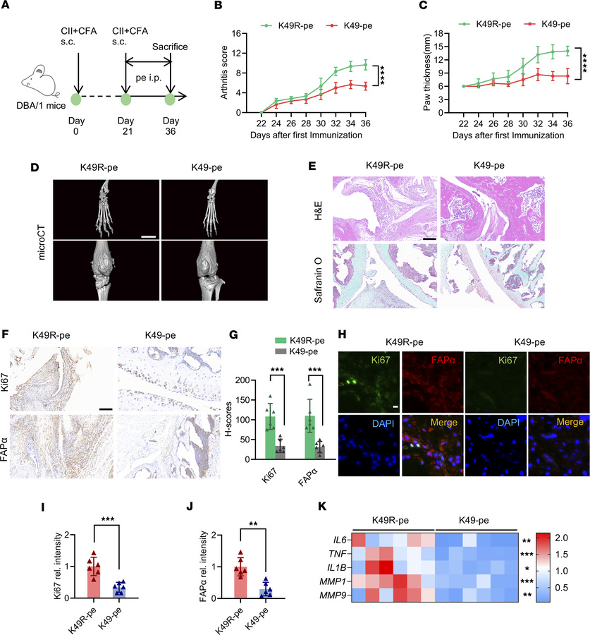 Targeting CRIP1 lactylation with a synthetic peptide suppresses RA progr...
