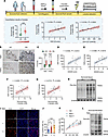 Enhanced lactate production and heightened protein lactylation drive synovi