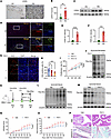Inhibition of lactate metabolism reduces synovial proliferation.