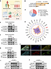 CRIP1 protein lactylation promotes synovial proliferation in RA.
