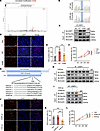 CRIP1 K49 lactylation facilitates synovial proliferation in RA.