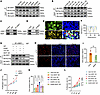 MOF mediates CRIP1 protein lactylation and synovial proliferation in RA.