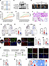 Inhibiting CRIP1 protein lactylation suppresses synovial proliferation and