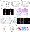 Targeting CRIP1 lactylation with a synthetic peptide suppresses RA progress
