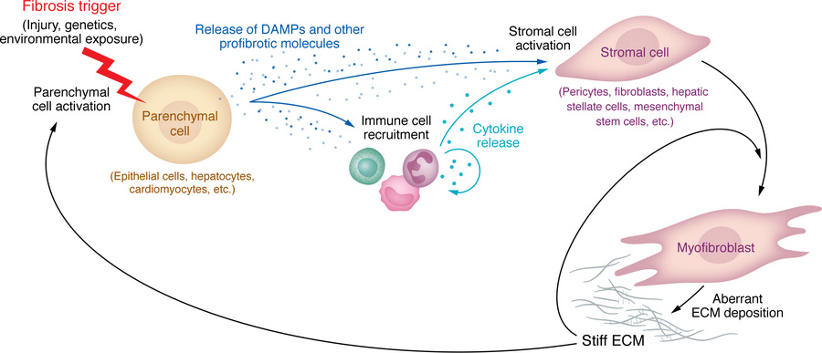 Shared pathways of fibrosis development.
In all organs, fibrosis can be ...