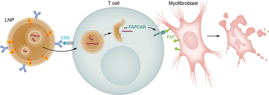 Generation of antifibrotic CAR T cells in vivo.
A lipid nanoparticle (LN...